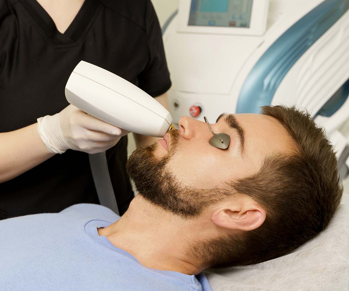 Rimozione angiomi e macchie solari