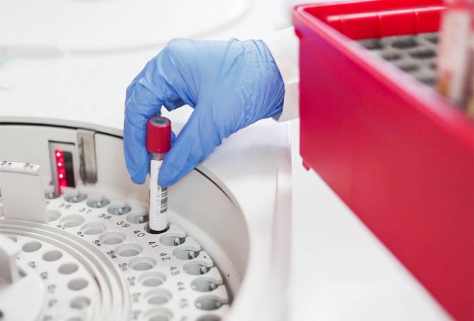 Assistenza infermieristica domiciliare