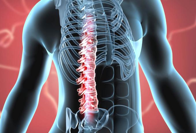 NEUROCHIRURGIA - Centro Biolab Cutrofiano