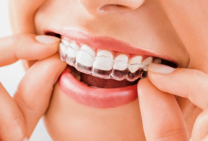 ORTODONZIA - Centro Biolab Cutrofiano