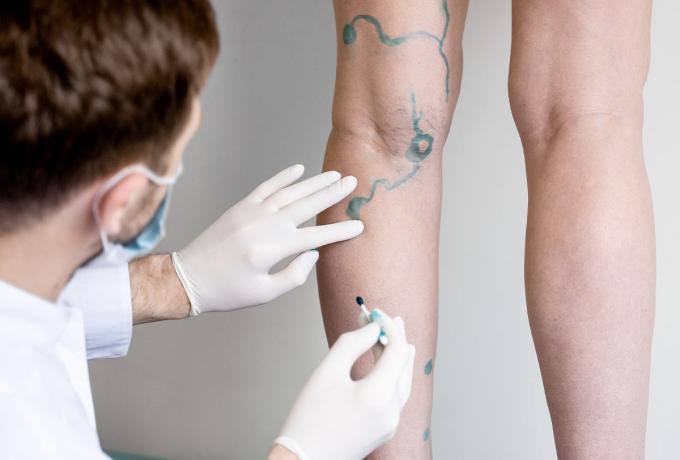 TRATTAMENTI LESIONI VASCOLARI - Centro biolab Cutrofiano